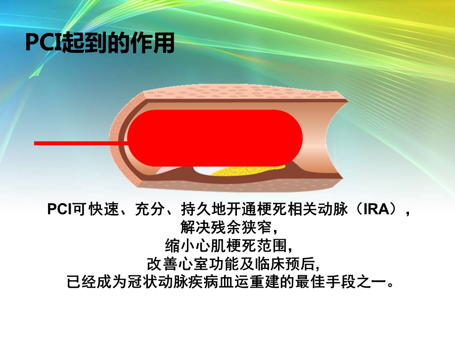 PCI围手术期他汀类药物的应用研究.ppt_第3页