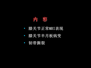 半月板和韧带核磁共振诊断.ppt