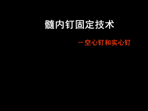 AO髓内钉固定技术.ppt