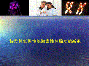 特发性低促性腺激素性性腺功能减退.ppt