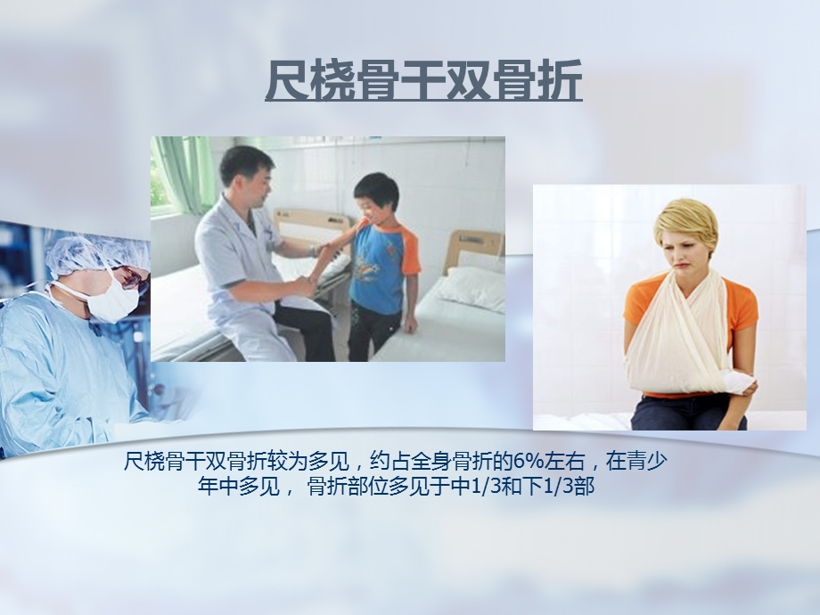 尺桡骨干双骨折.ppt_第1页