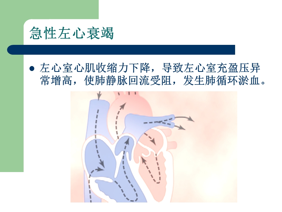 心衰治疗新进展PPT.ppt_第3页