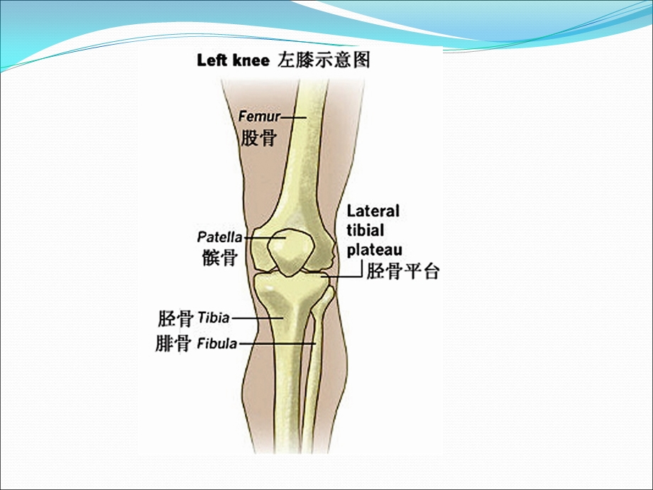 医学ppt胫骨平台骨折的护理.ppt_第2页