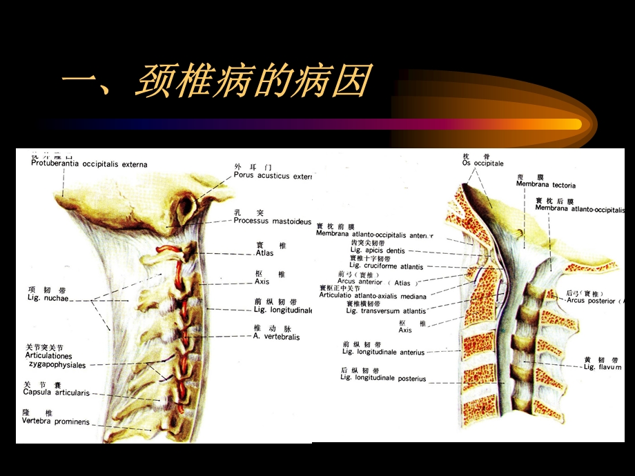 第六节颈椎病.ppt.ppt_第3页