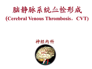 颅内静脉血栓形成.ppt.ppt