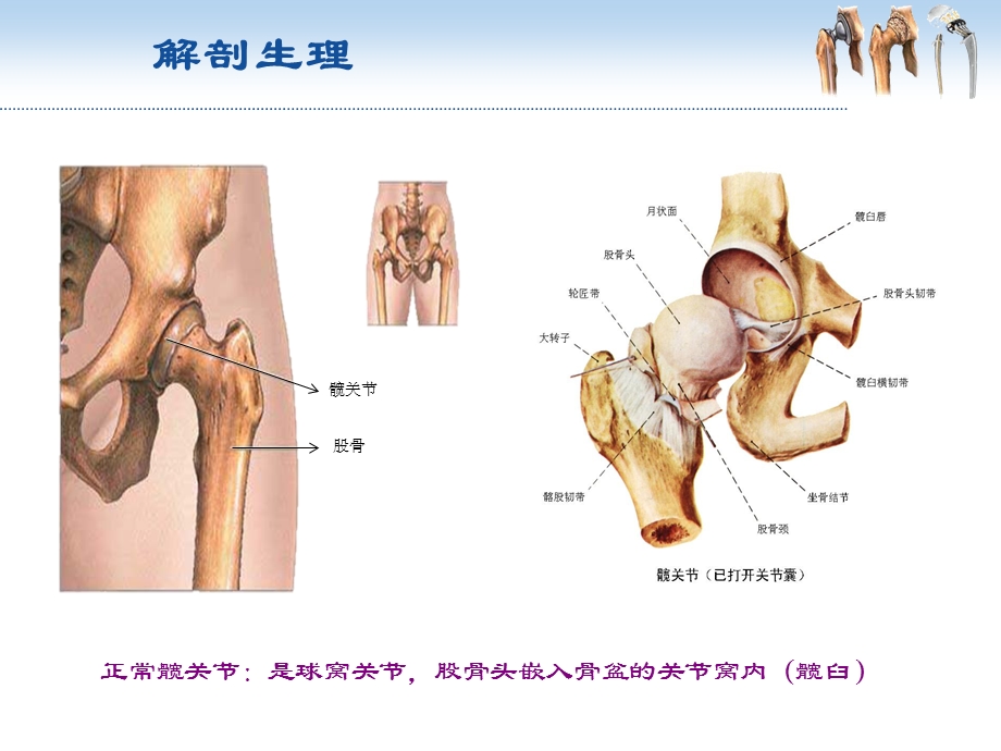 髋关节置换术后功能锻炼.ppt_第3页