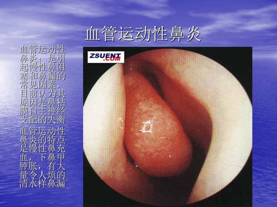 鼻的解剖图及手术图.ppt_第2页