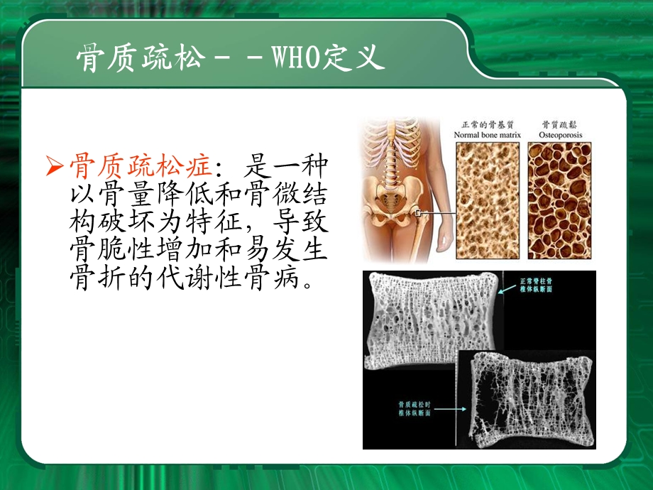 骨科常见病.ppt_第3页