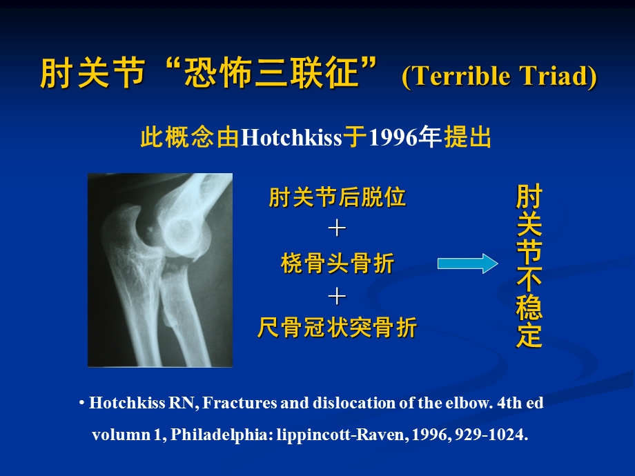 肘关节恐怖三联征的规范化外科治疗 .ppt_第2页