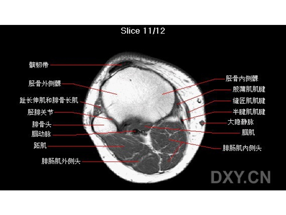 膝关节解剖.ppt_第2页