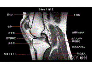 膝关节解剖.ppt