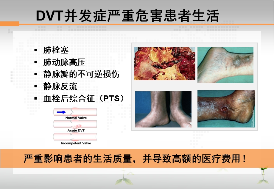 骨科大手术后VTE预防..ppt_第3页