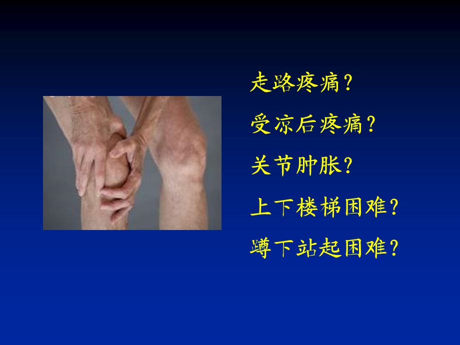 膝骨关节炎科普讲座上传.ppt.ppt_第3页