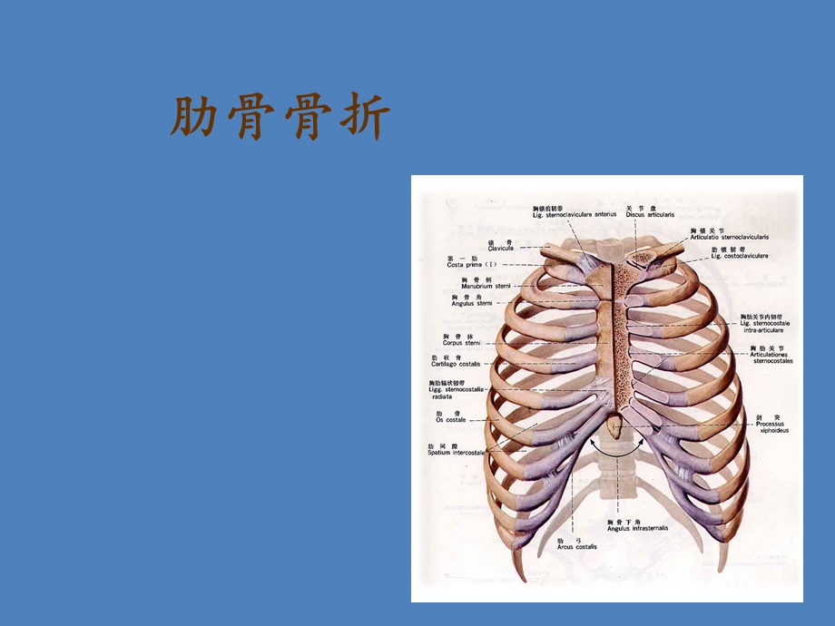 肋骨骨折的护理 .ppt_第1页