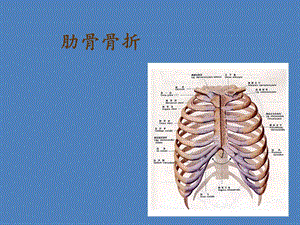 肋骨骨折的护理 .ppt