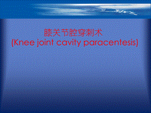 膝关节穿刺术.ppt