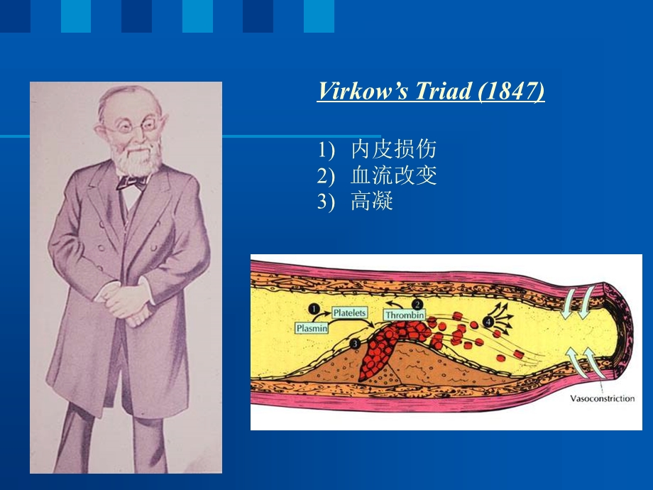 血栓防治新证据和新指南.ppt_第2页