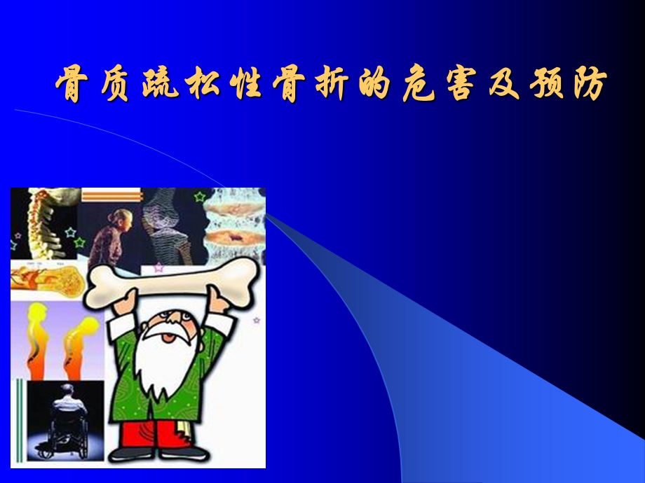 骨质疏松性骨折的危害及预防.ppt_第1页