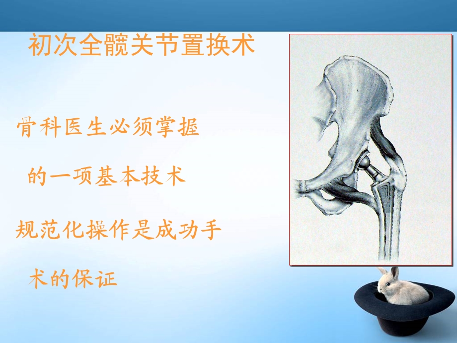 全髋关节置换手术技巧.ppt_第2页