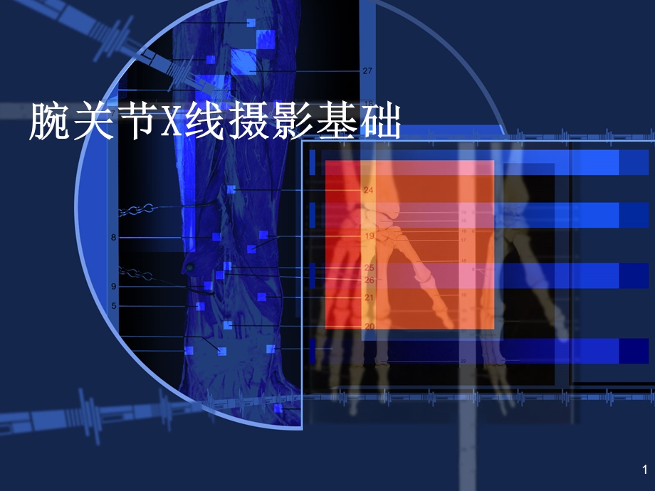 腕关节常见骨折与摄影方法.ppt_第1页