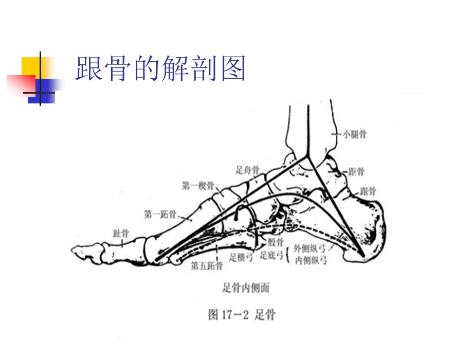 跟骨骨折病人的护理.ppt_第3页