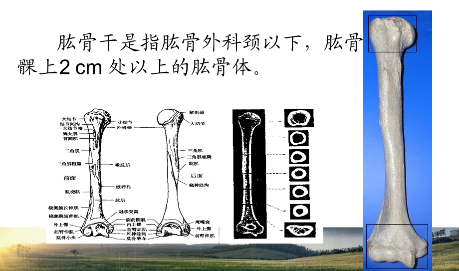 肱骨干骨折.ppt_第2页