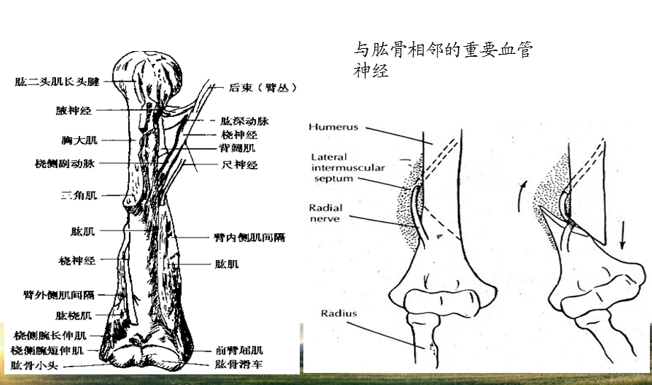 肱骨干骨折.ppt_第3页