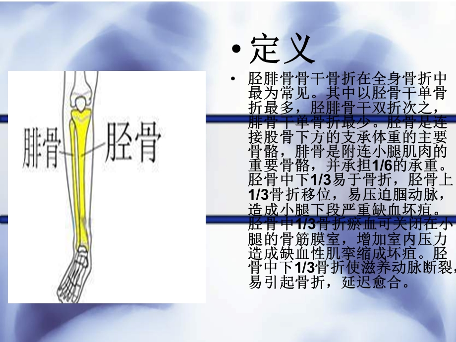 胫腓骨骨折围手术期的护理.ppt_第3页