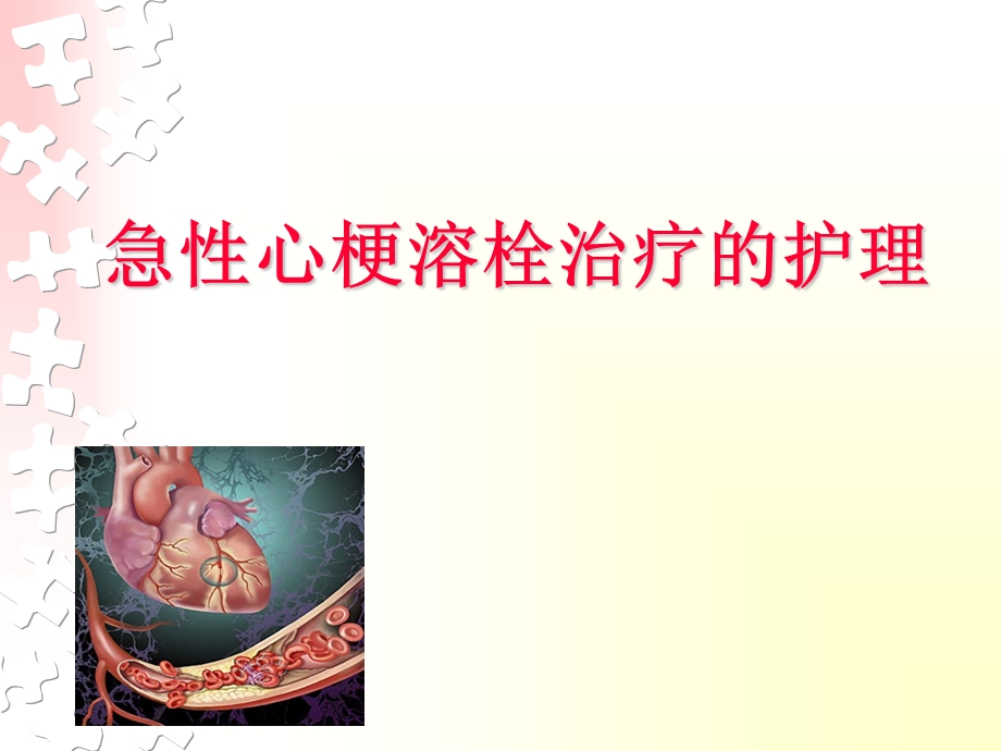 急性心梗溶栓治疗的护理.ppt_第1页