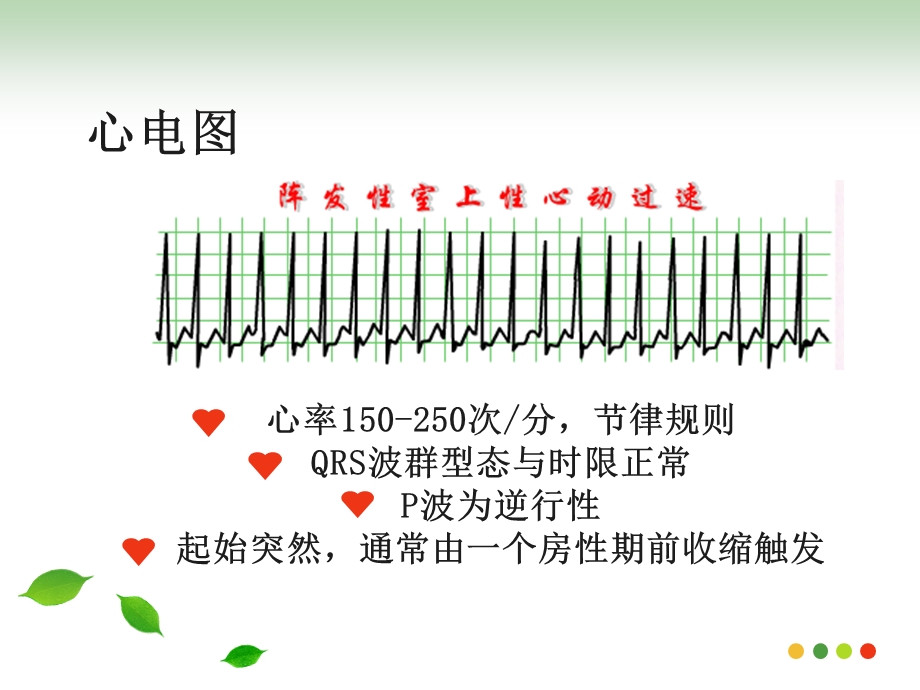 心内科护理查房—阵发性室上性心动过速.ppt_第3页