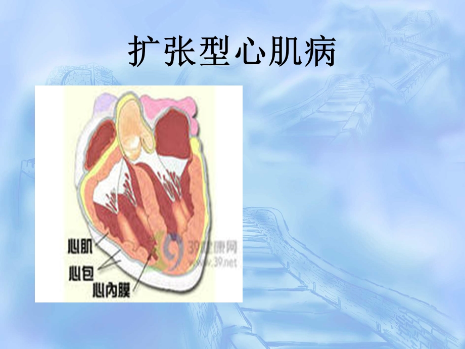 扩张型心肌病查房.ppt_第1页