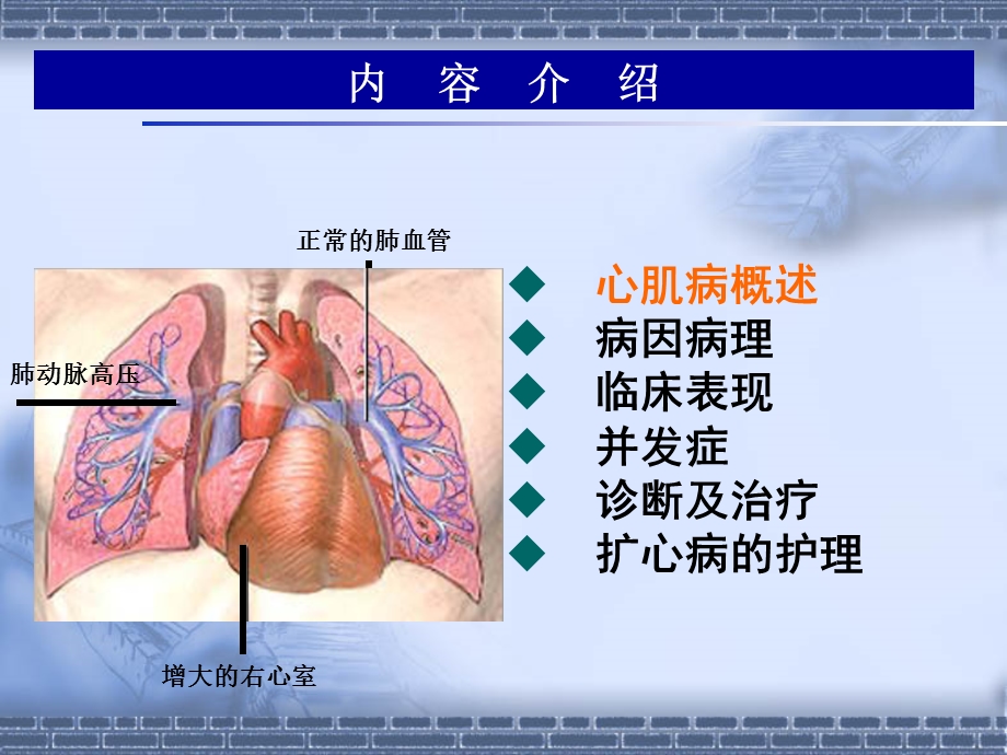 扩张型心肌病查房.ppt_第2页