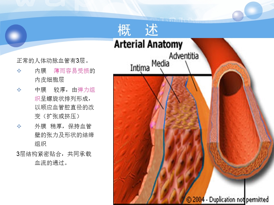 主动脉夹层的护理.ppt_第3页