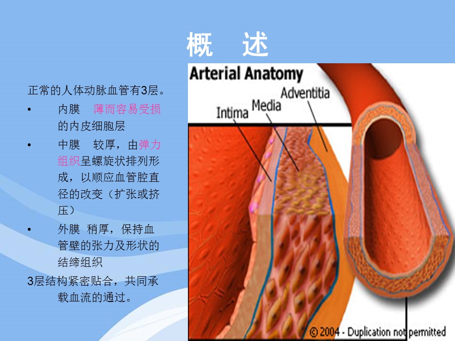 主动脉夹层患者的护理.ppt_第3页