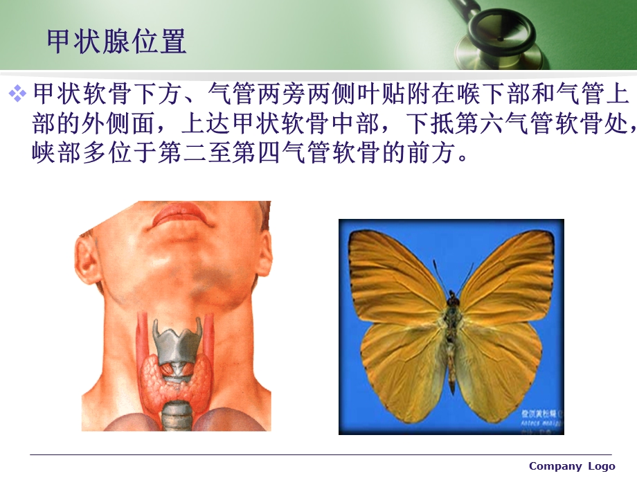 甲状腺的术后护理.ppt_第3页