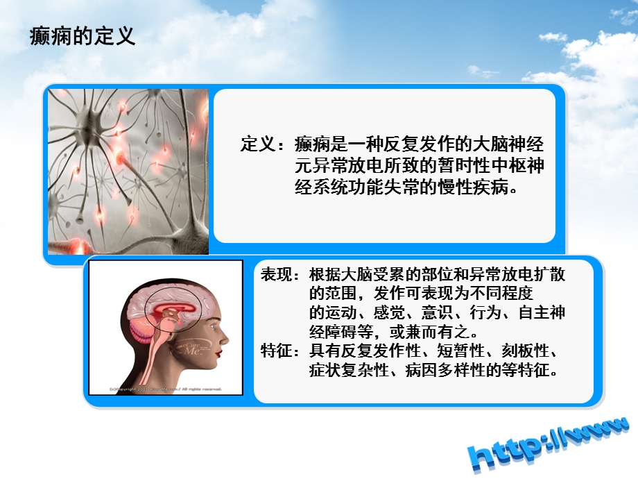 癫痫急救护理PPT.ppt_第3页