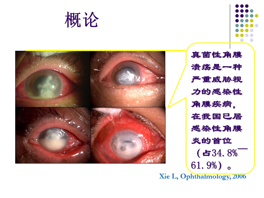 真菌性角膜炎.ppt_第2页