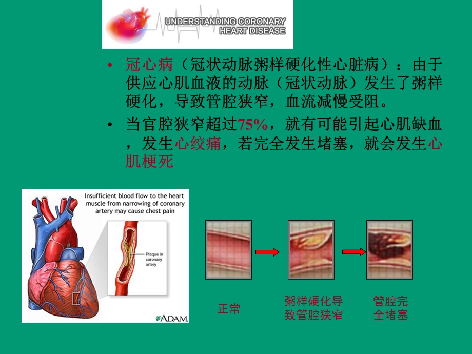 CCU护理查房.ppt_第3页