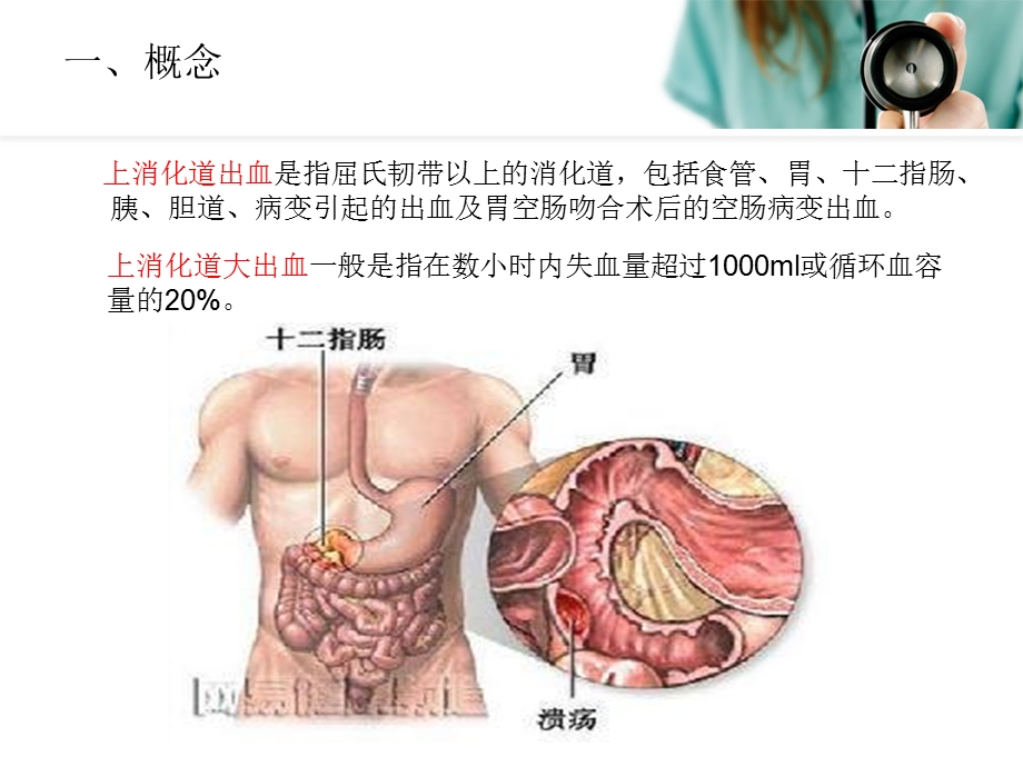 上消化道大出血患者的护理.ppt_第3页