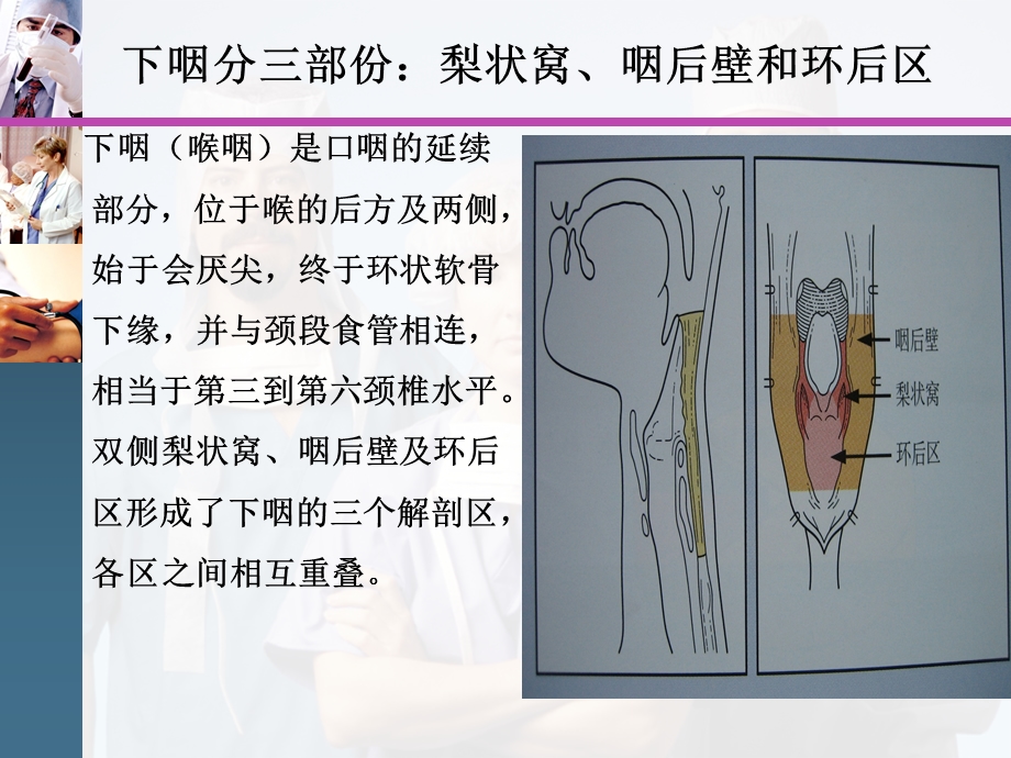 下咽癌护理查房.ppt_第3页