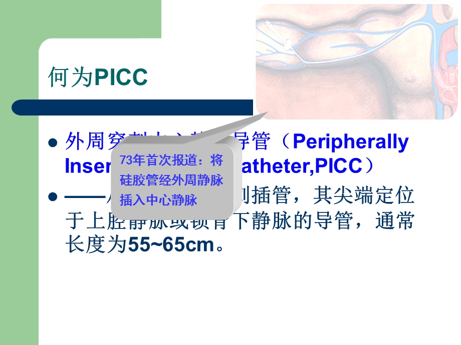 PICC置管操作及管理.ppt_第2页