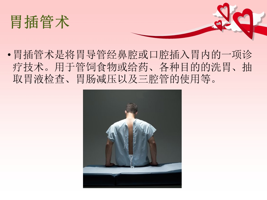 胃管护理终稿.ppt_第2页