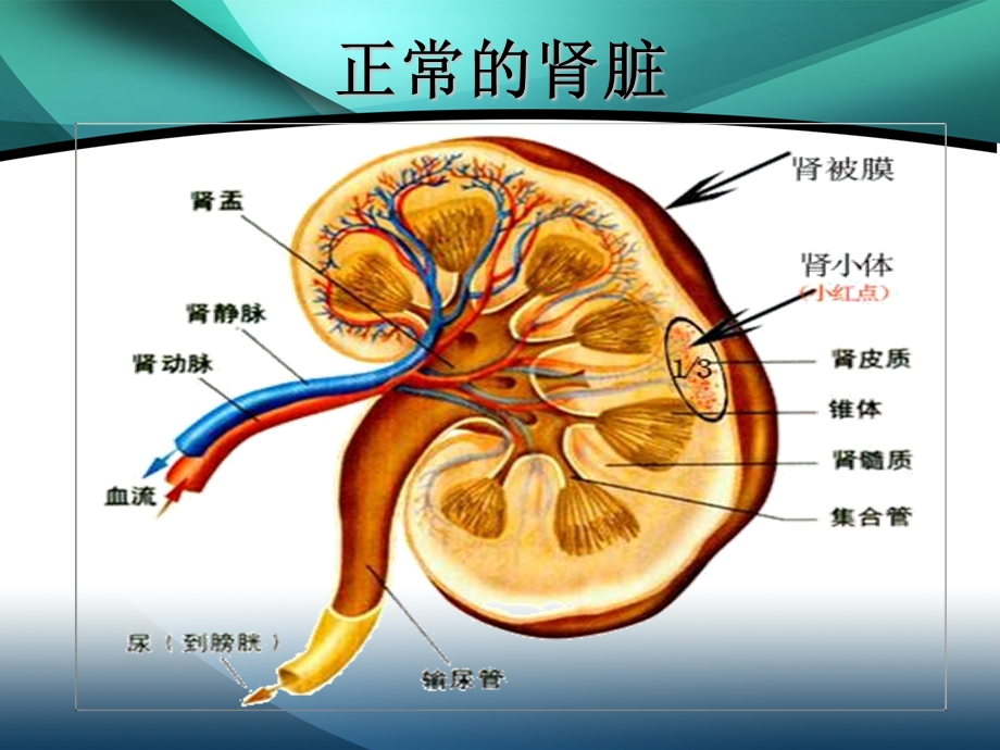 肾囊肿的护理.ppt_第2页