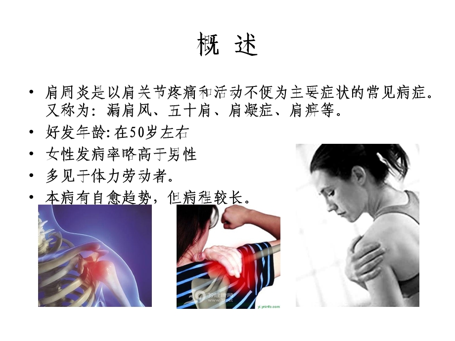 肩周炎的护理.ppt_第2页