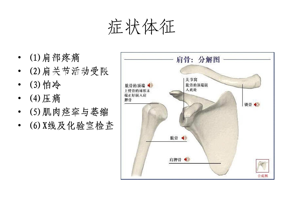 肩周炎的护理.ppt_第3页