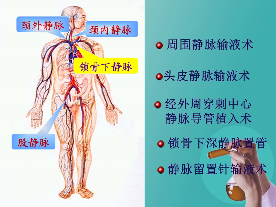 静脉留置针的护理.ppt_第2页