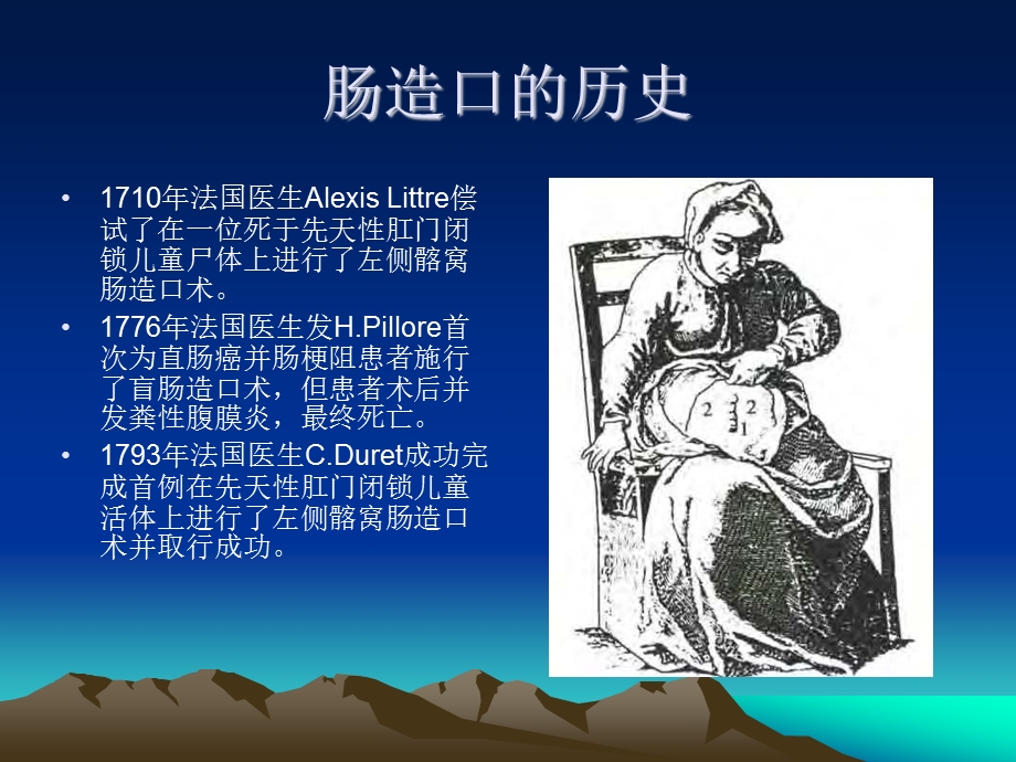 肠造口的护理.ppt_第3页