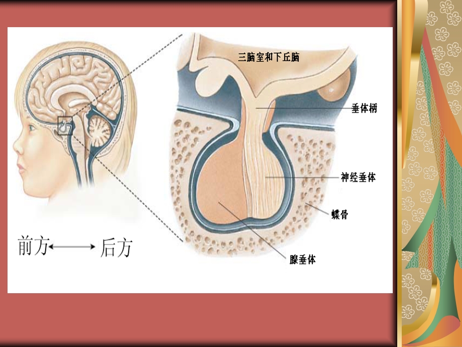 鞍区占位的围手术期护理.ppt_第3页