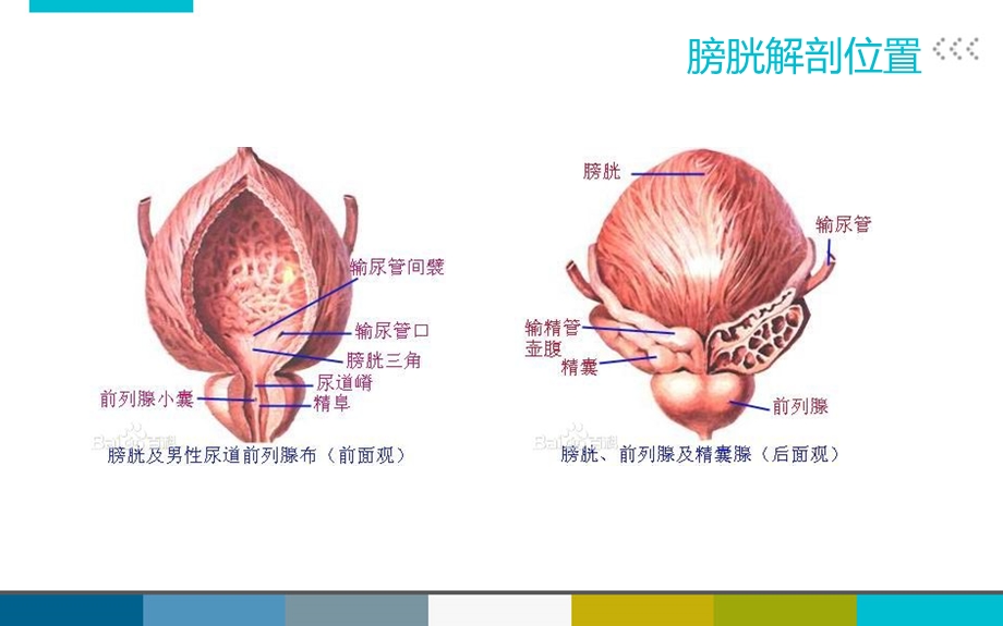 膀胱癌患者护理查房.ppt_第2页