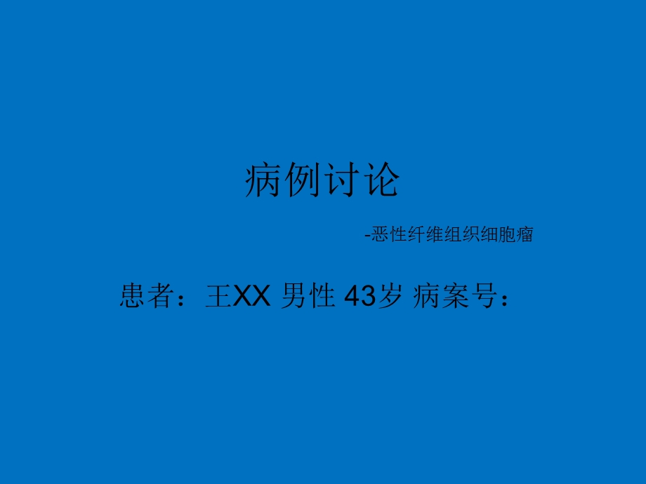 恶性纤维组织细胞瘤ppt幻灯片.ppt_第1页